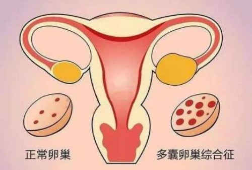 成都三代试管助孕：治疗不孕不育中药方剂，这些助孕偏方的效果具佳